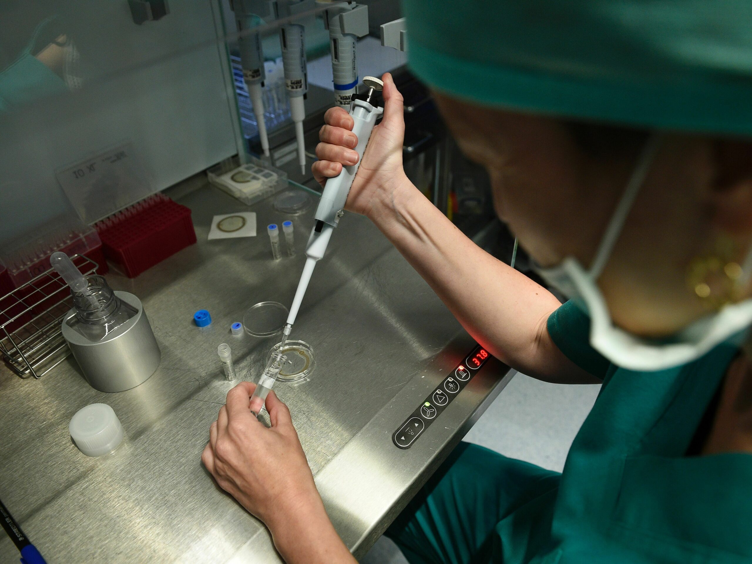 Creating a sperm or egg from any cell? Reproduction revolution on the horizon